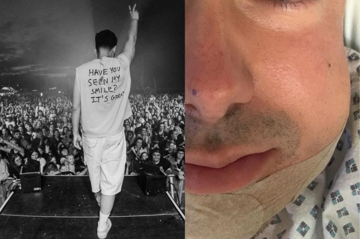 Ilustračný obrázok k článku Hviezdny český spevák dostal brutálnu BITKU! Vraj je za tým balenie nesprávnej ženy