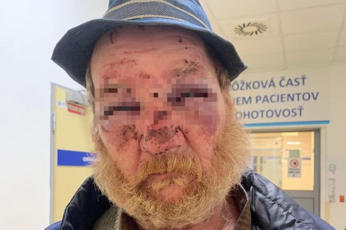 Ilustračný obrázok k článku HROZIVÝ pohľad na DOBITÉHO Jána: Po ÚTOKU zakročil samotný primátor