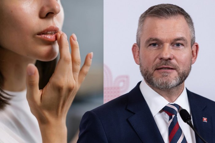 Ilustračný obrázok k článku Slovákov ŠOKOVALA faktúra prezidentskej kancelárie: 1 400 eur za balzam na pery? TAKTO to je!