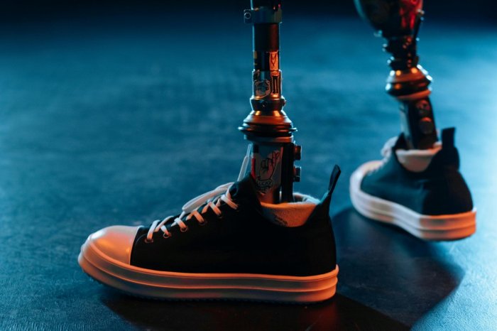 Ilustračný obrázok k článku Jaroslavovi AMPUTOVALI obe nohy: Vraj je to len KOZMETICKÁ vada, povedali úradníci