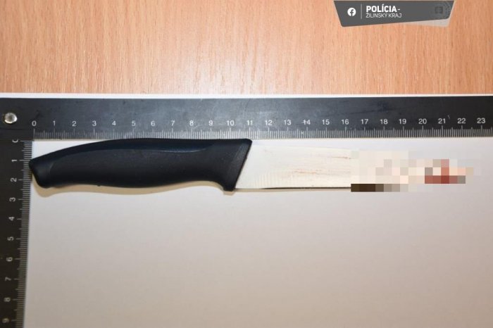 Ilustračný obrázok k článku Hádka vyústila do krvavej DRÁMY: Žena mala na muža ZAÚTOČIŤ nožom