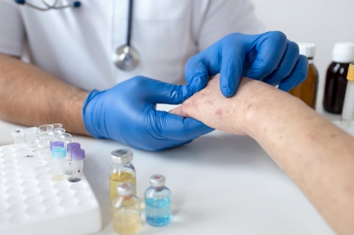 Ilustračný obrázok k článku OSÝPKY v Nitre! Zo zahraničia si ich doniesla 35-ročná ŽENA