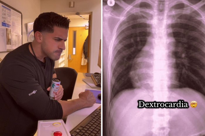 Ilustračný obrázok k článku Rádiológ sa pozrel na röntgen a prišiel ŠOK! Pacient mal srdce na INOM mieste