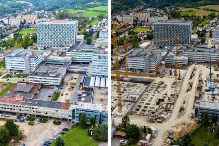 Ilustračný obrázok k článku Stavba NOVEJ nemocnice má 1. narodeniny: Porovnanie ZÁBEROV hovorí za všetko, FOTO