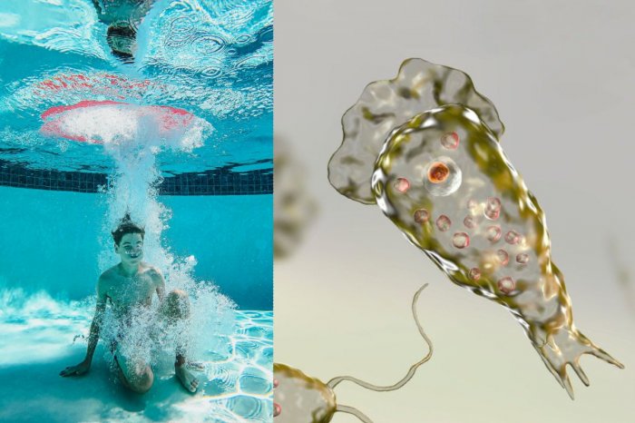 Ilustračný obrázok k článku Po SMRTI chlapca (†11) sprísnia kontroly kúpalísk! ČO potrebujete vedieť o SMRTEĽNOM parazitovi?