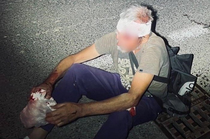 Ilustračný obrázok k článku Muž po ošetrení v nemocnici SPADOL: Hlavu mu museli ZAŠIŤ znova