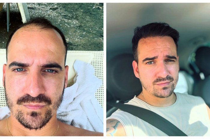 Ilustračný obrázok k článku Petraník sa zmenil, stálo ho to tisícky eur: Je to NAJLEPŠIA investícia do seba!