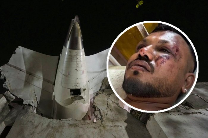 Ilustračný obrázok k článku Ako jediný PREŽIL haváriu lietadla v Indii: Má nočné MORY! Vidí ZOMIERAŤ ľudí