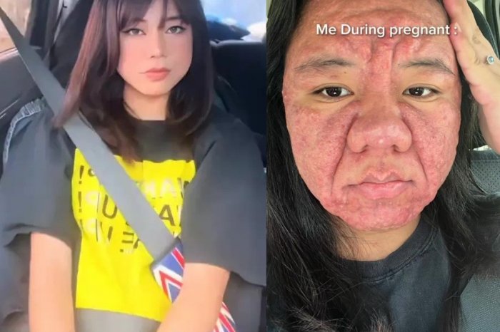 Ilustračný obrázok k článku Krásnej brunetke ZDEFORMOVALO tehotenstvo tvár: Prečo má tak OBROVSKÝ nos?