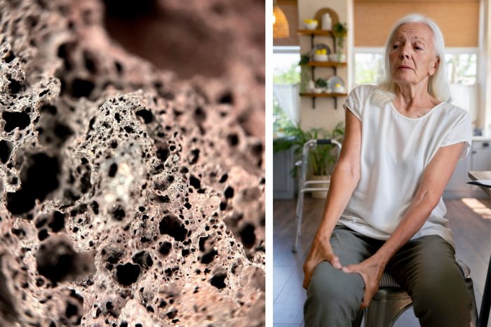 Ilustračný obrázok k článku Slováci, nepodceňujte to! Osteoporóza môže mať VÁŽNE následky