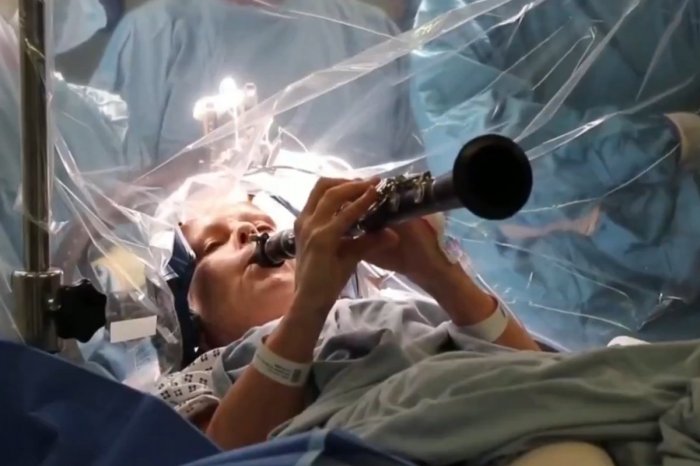 Ilustračný obrázok k článku Neuveriteľné VIDEO: Žena počas operácie mozgu hrala na KLARINETE