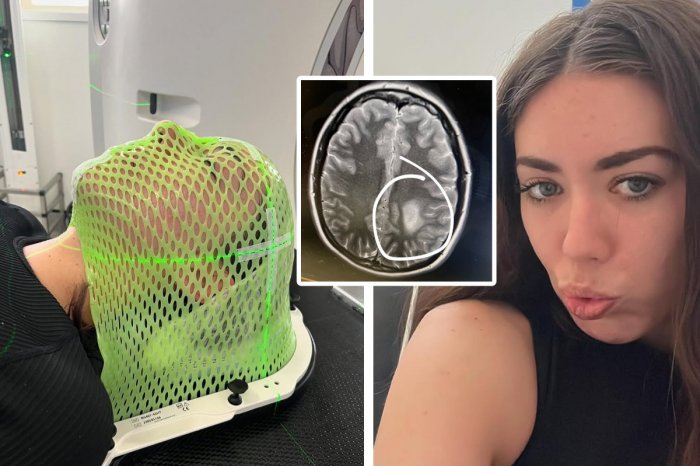 Ilustračný obrázok k článku Mladej žene povedali, že ZOMRIE na rakovinu: Lekári nechápu! Veľký nádor ZMIZOL