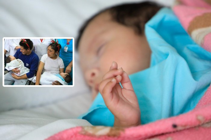 Ilustračný obrázok k článku Vianočný ZÁZRAK, jasajú lekári: Podarilo sa im ODDELIŤ 2-mesačné siamské dvojčatá!