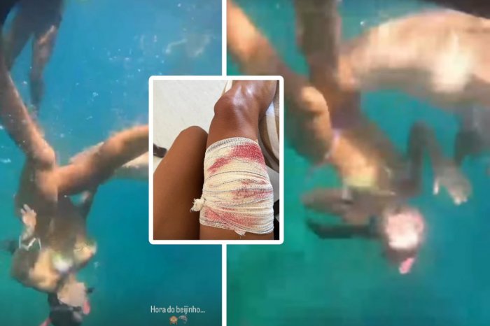 Ilustračný obrázok k článku Šnorchlovanie sa zmenilo na HOROR: Žene sa do stehna ZAHRYZOL žralok! VIDEO