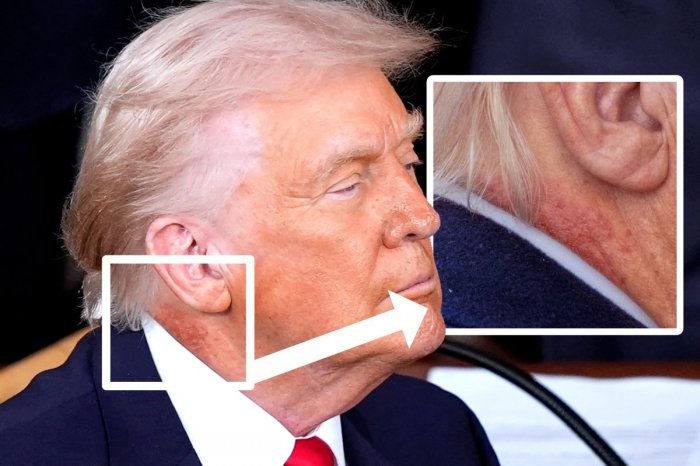 Ilustračný obrázok k článku ZÁHADNÁ škvrna: Šíria sa špekulácie o Trumpovom zdraví! Ako to vysvetlil Biely dom?