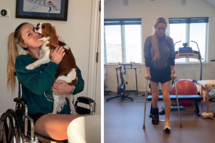 Ilustračný obrázok k článku Lyžiarka Vonnová po tom, čo takmer prišla o nohu: Nedokážem ani vstať a spraviť raňajky