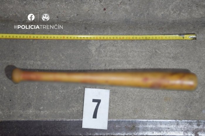 Ilustračný obrázok k článku BRUTÁLNY útok v slovenskom meste: Muž ZMLÁTIL dvoch ľudí bejzbalkou!