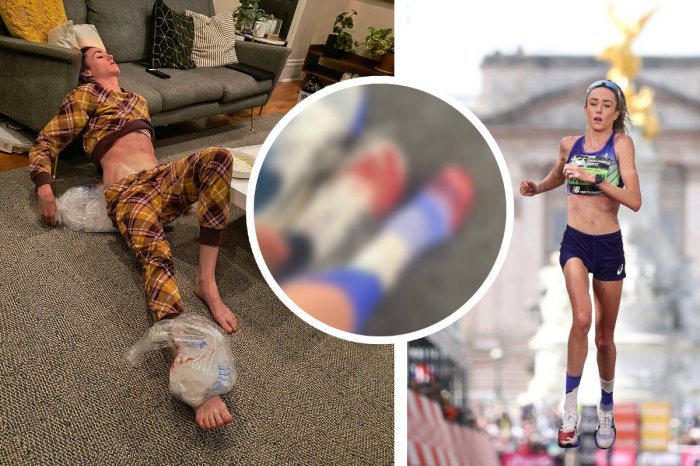 Ilustračný obrázok k článku KRV jej striekala z topánky! Zranená bežkyňa dobehla maratón: Akoby mi EXPLODOVALA noha