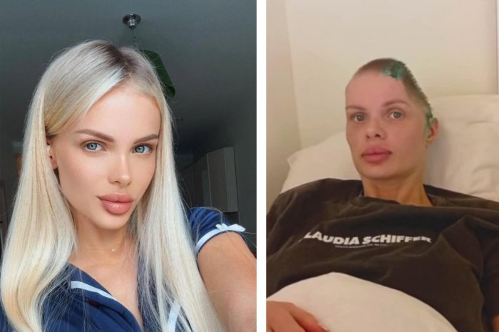 Ilustračný obrázok k článku Modelku zmlátil tak, že jej museli ODSTRÁNIŤ kus lebky! Keď sa dozvedel trest, ZOMREL