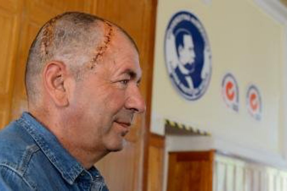 Mužovi do lebky voperovali lekári unikátny slovenský implantát