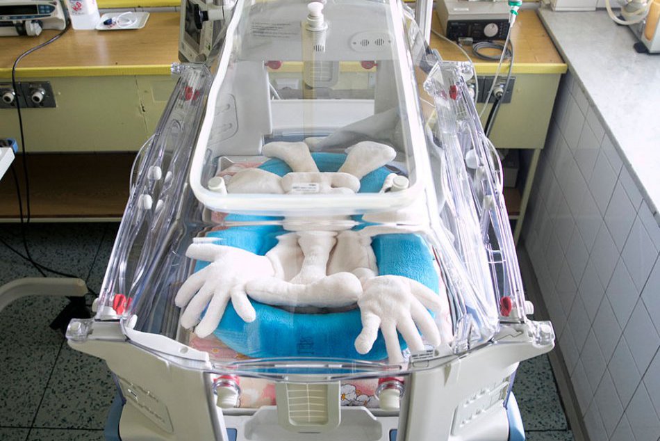 Žilinská nemocnica dostala tri inkubátory