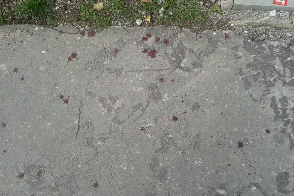FOTO: Stopy krvi sa objavili na sídlisku v Liptovskom Mikuláši