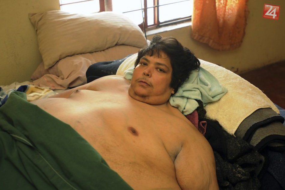 Sme obézni? Štatistika ukázala že jeden z troch Slovákov áno