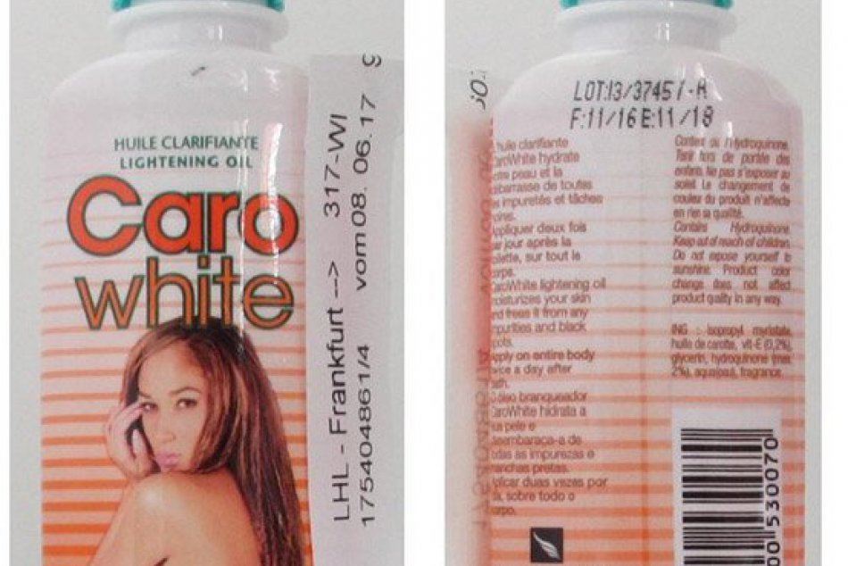 Hygienici upozorňujú na nebezpečnú kozmetiku: Môže spôsobiť alergie