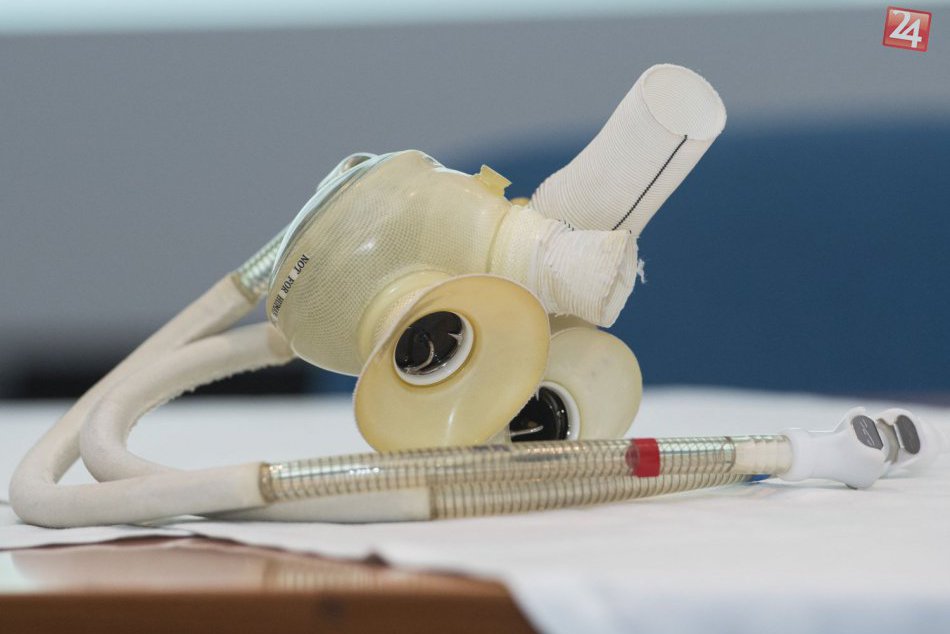 Slovensko má prvého pacienta s implantovaným umelým srdcom