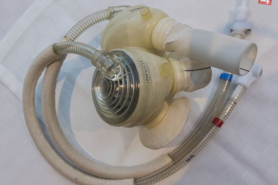 Jozef z Topoľčian je prvým Slovákom s umelým srdcom