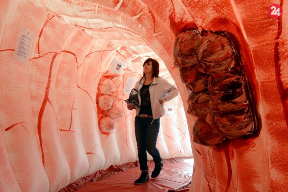 Skríning rakoviny hrubého čreva a konečníka: Jednoduchý test môže zachrániť živo