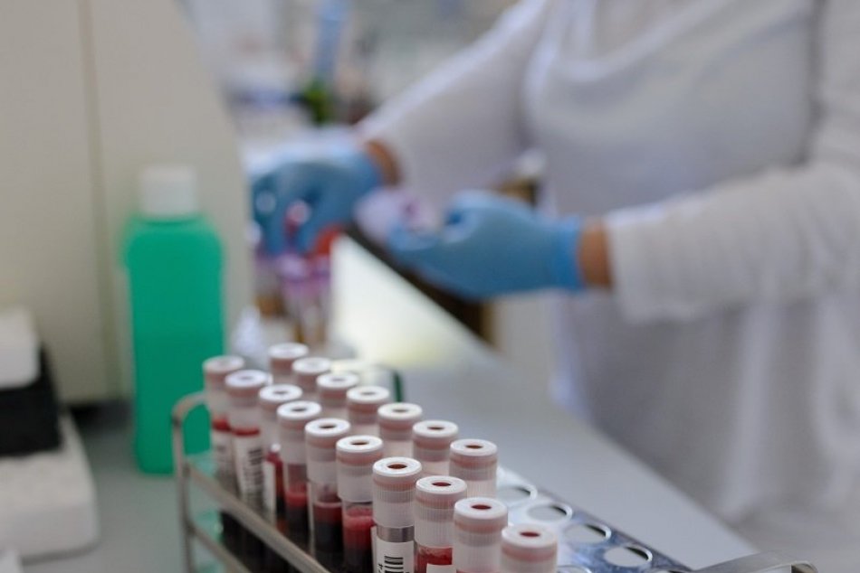 DOD v Národnej transfúznej službe v Nitre