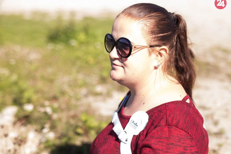 Dievča na fotkách je Popradčanka Dominika: Musí bojovať s ťažkým údelom