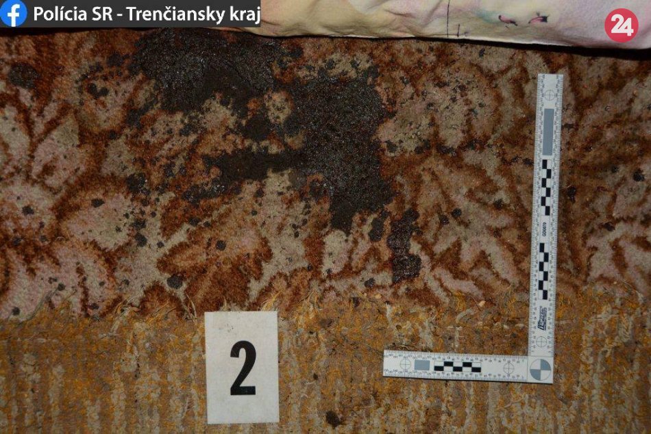 FOTO: Útok muža (42) na exmanželku (39) kyselinou