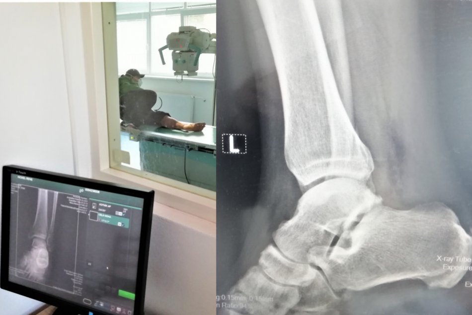 Röntgenológia v Zlatých Moravciach