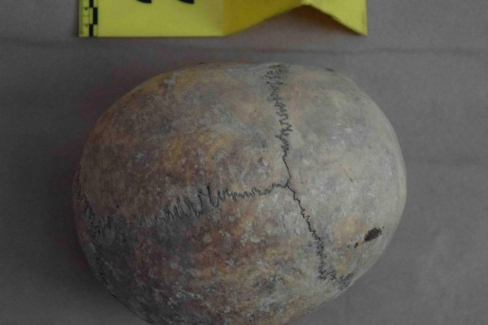 V OBRAZOCH: V bystrickom paneláku objavili ľudské lebky