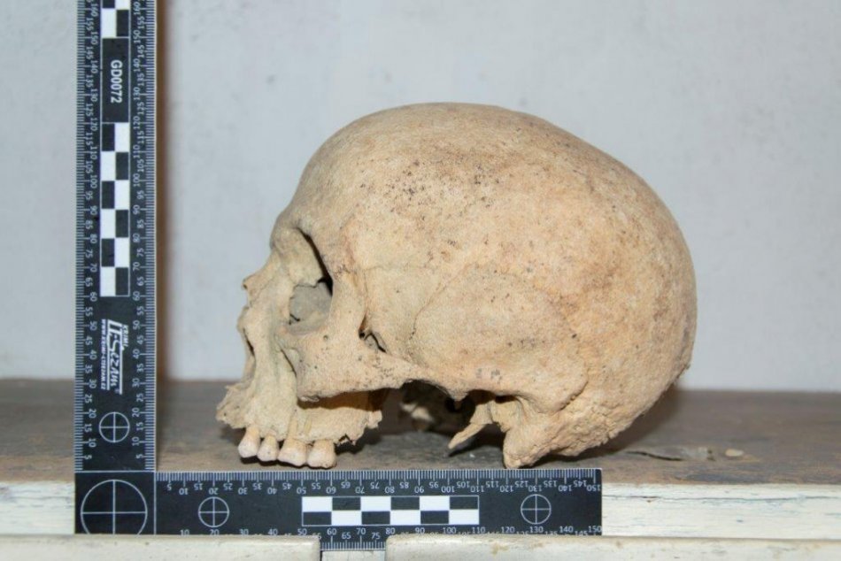 Objektívom: Nález ľudskej lebky v Prešove vrhá zimomriavky
