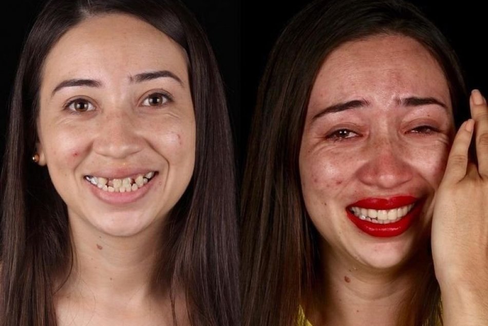 FOTO: Zubár vrátil pacientom chrup a zmenil ich na nepoznanie!