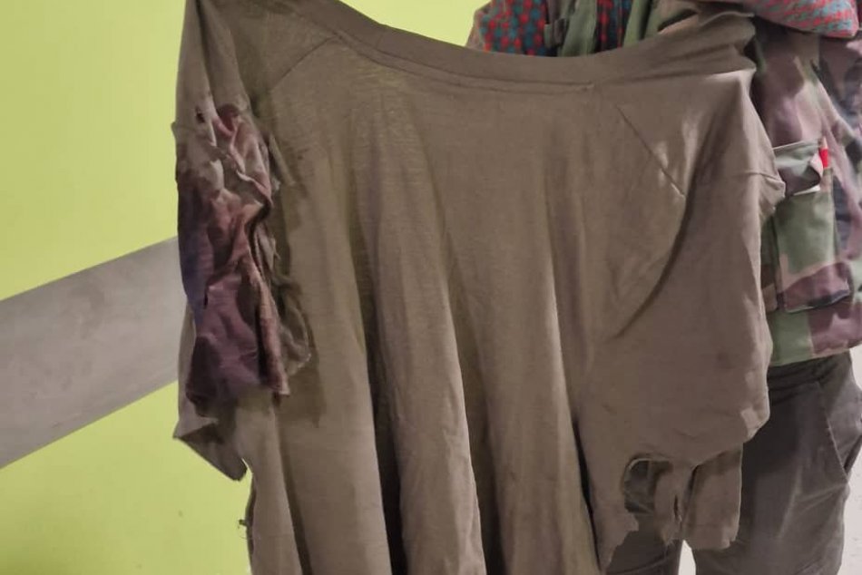 Oblečenie muža napadnutého medveďom