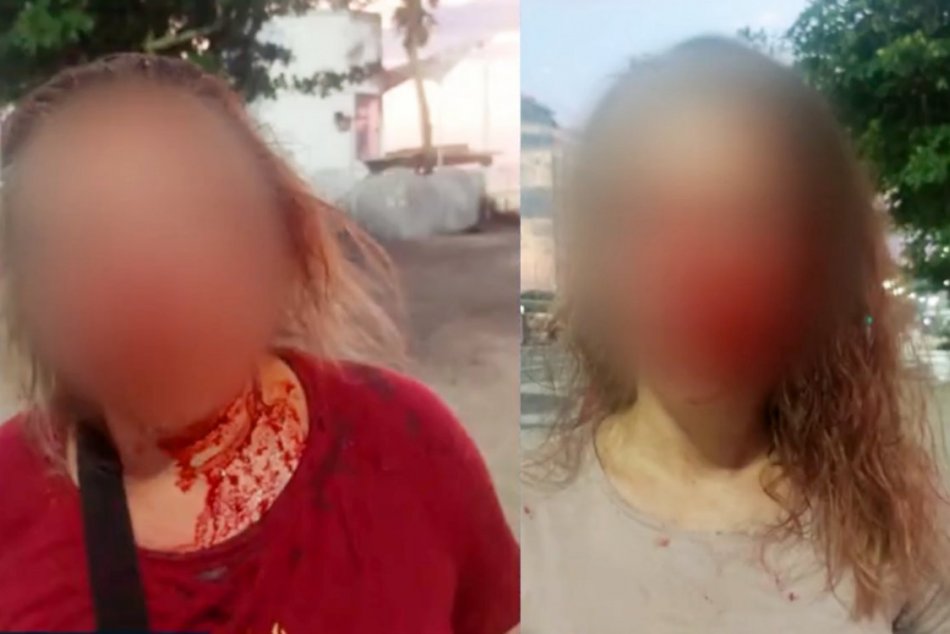 Slovenky dobili na pláži v Brazílii