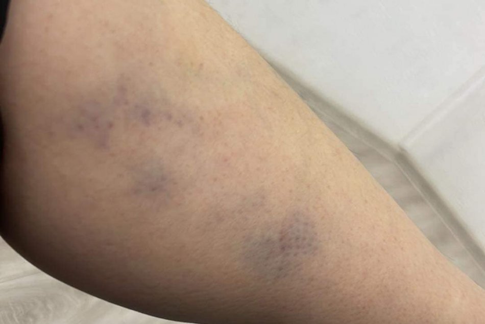 V trnavskom nákupnom centre zbili zamestnankyne nechtového štúdia