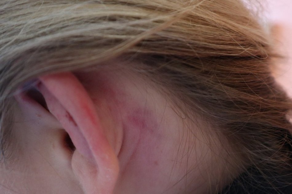 FOTO: Mladé dievča napadlo stádo kráv. Obkolesili ju a dupali po nej!