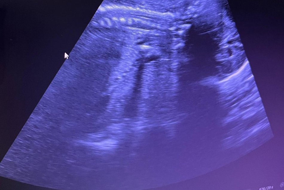 Juraj Droba sa stane otcom