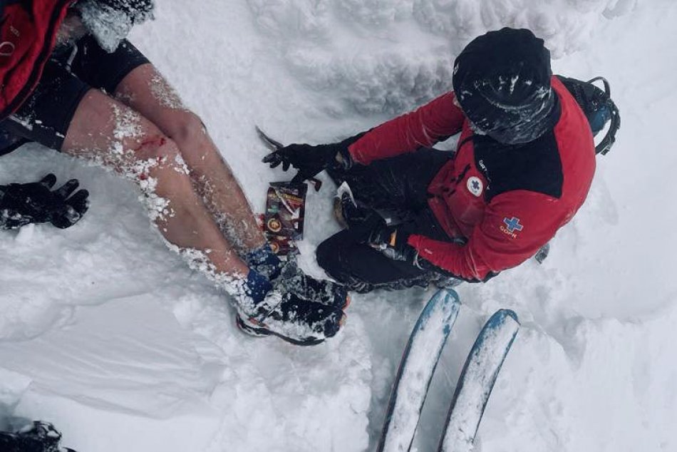 Turista v letnom oblečení sa vybral na Babiu horu