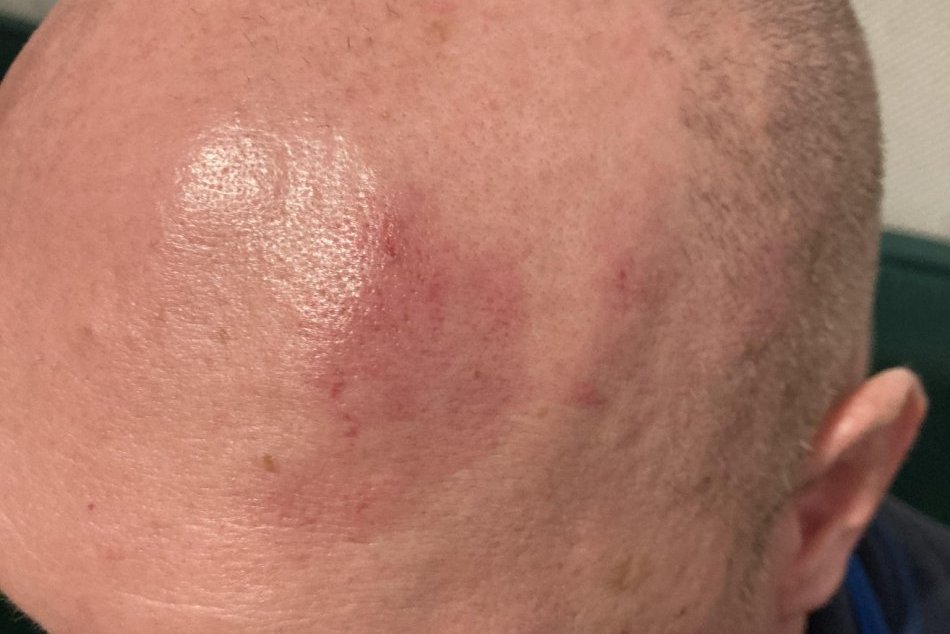 Policajný zásah na vodiča v Žiline