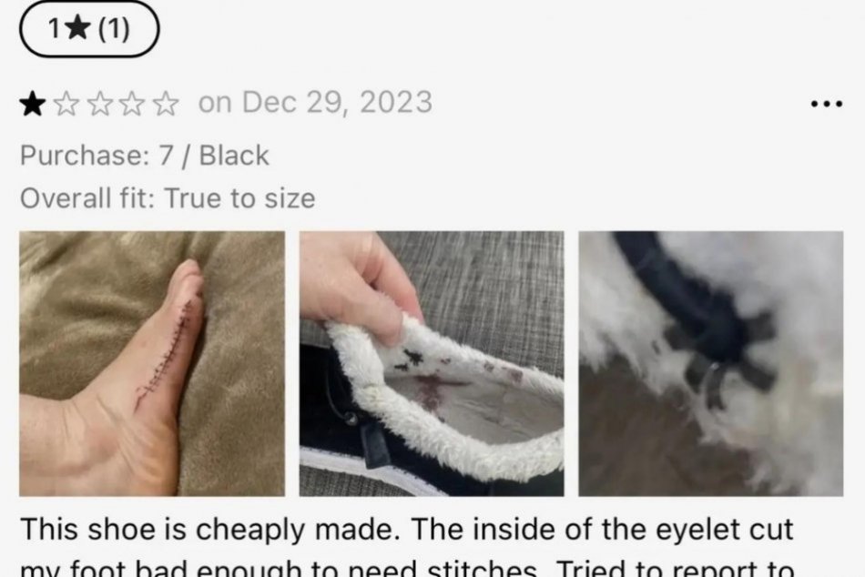 Topánky z Temu spôsobili žene zranenie