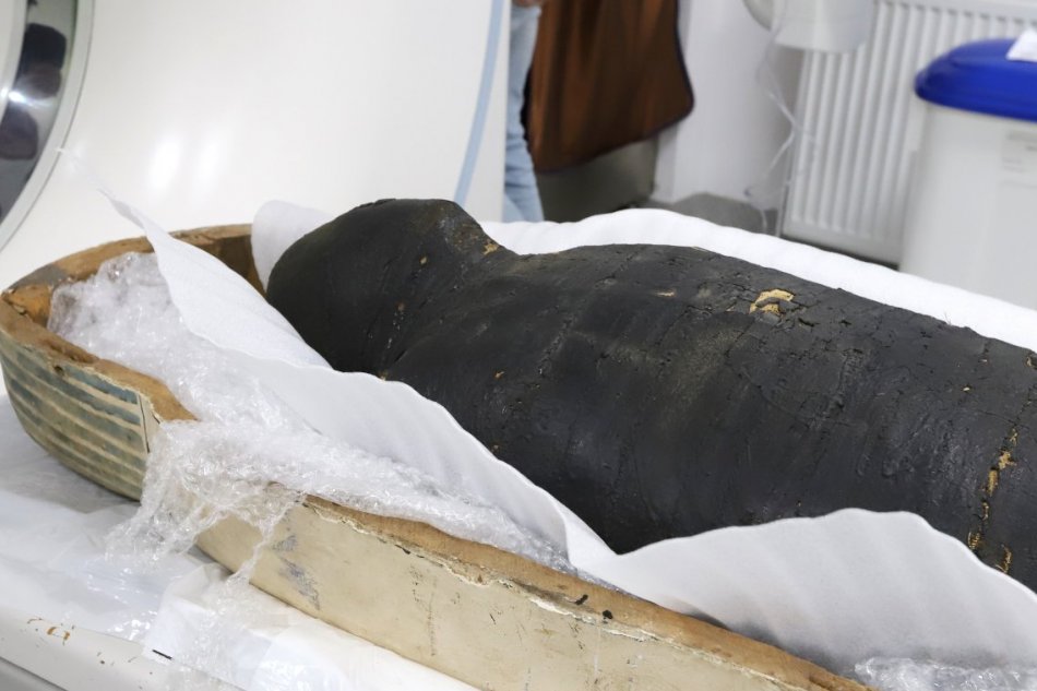 V OBRAZOCH: CT vyšetrenie mumifikovanej ženy