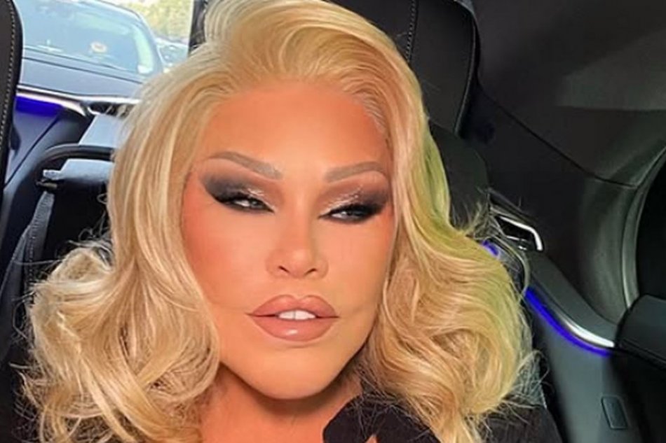 Mačacia žena Jocelyne Wildenstein
