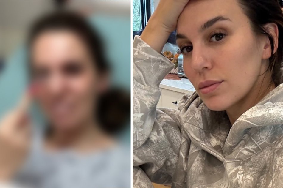 Herečku Christy Carlson Romano postrelili do tváre