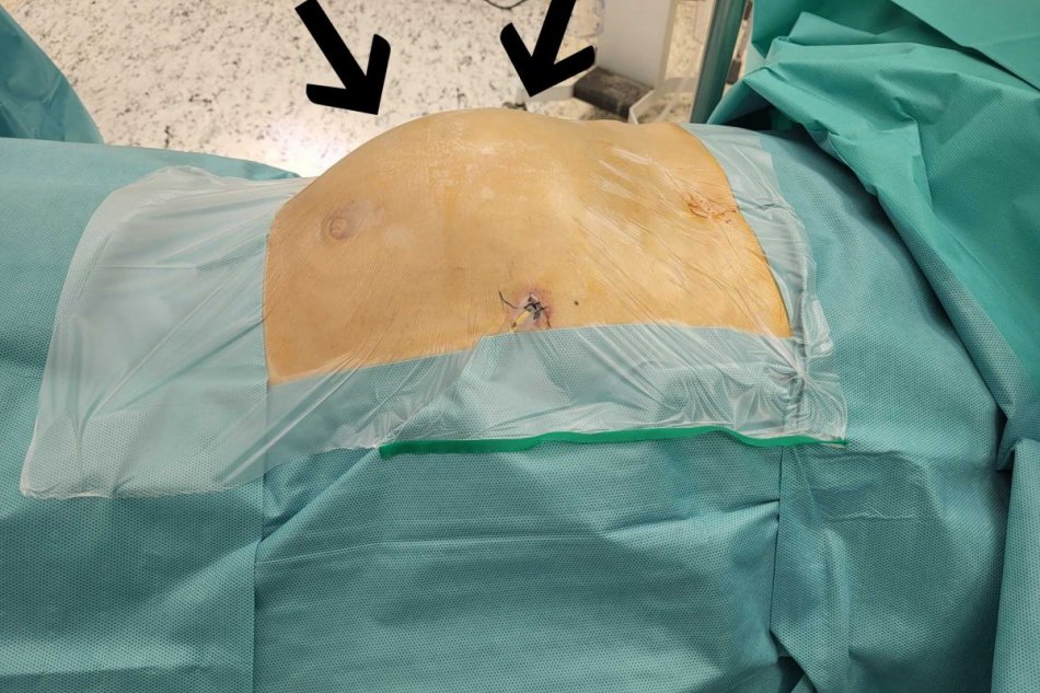 V OBRAZOCH: V Rooseveltovej nemocnici vzniklo v apríli Centrum echinokokózy